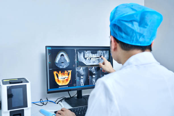 Best Emergency Wisdom Teeth Removal in Thorntown, IN