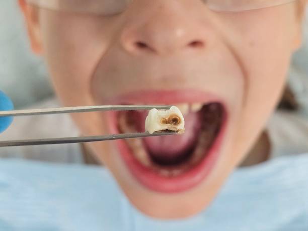 Best Emergency Treatment for Toothache in Thorntown, IN